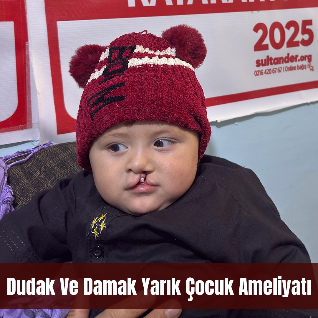 Dudak ve Damak Yarığıyla Dünyaya Gelen Yavrumuza Destek